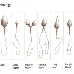 Conceiving Calculator - Natural Treatment For Women Not Getting Pregnant